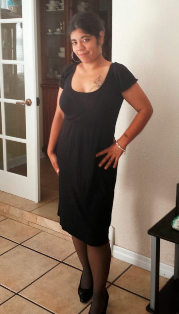 after bariatric surgery